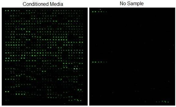 Human Glycosylation Array 1000
