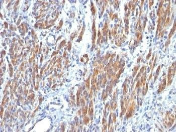 Anti-SM-MHC Antibody