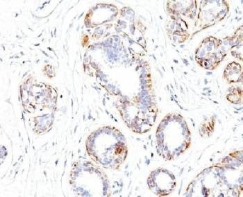 Anti-SM-MHC Antibody