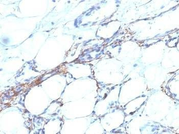 Anti-SM-MHC Antibody