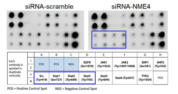 RayBiotech's JAK/STAT Signaling Antibody Array revealed NME4 knockdown reduced STAT phosphorylation in esophageal squamous cell carcinoma cells. Figure adapted from Zheng et al., Biochem Biophys Res Commun, 2020.