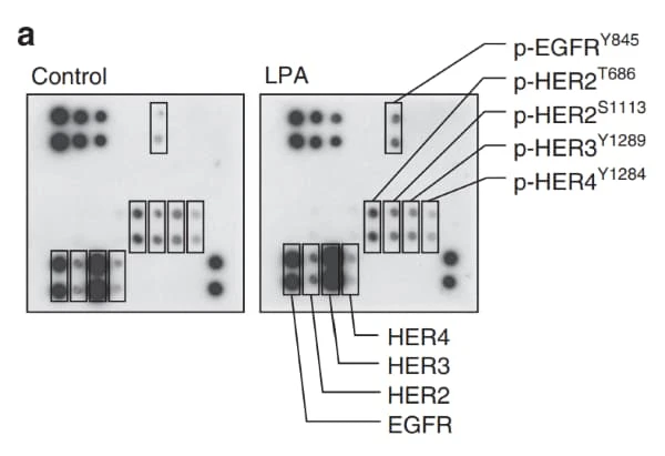 RayBiotech's EGFR Phosphorylation Antibody Array revealed SRC-mediated phosphorylation of EGFR-Y845 in ovarian cancer cells stimulated with lysophosphatidic acid. Figure adapted from Panupinthu et al., Oncogene, 2013.