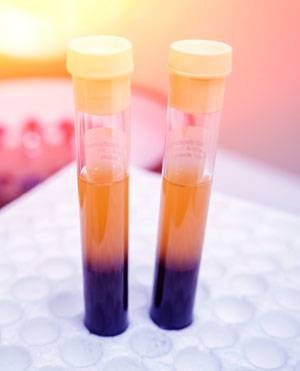 COVID-19 Serum or Plasma Sample Set