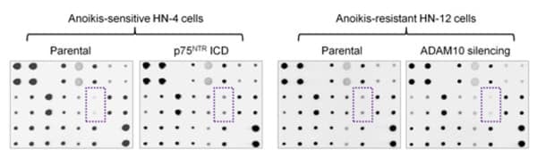 RayBiotech's Apoptosis Signaling Antibody Array identified increased NFkB activity in anoikis-resistant cancer cells. Figure adapted from Bao et al., Cancer Res, 2018.