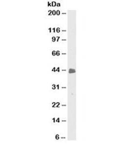 Anti-Cytokeratin 8 + 18 Antibody