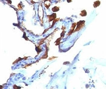 Anti-Cytokeratin 8 + 18 Antibody