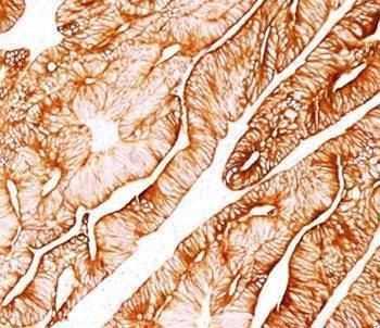 Anti-Cytokeratin 8 Antibody