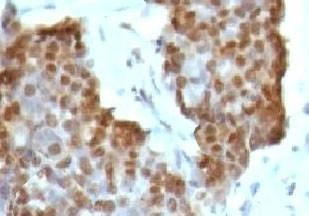 Anti-Estrogen Receptor beta Antibody