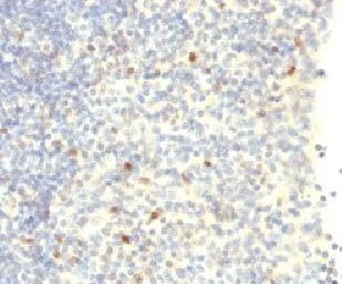 Anti-FOXP3 Antibody