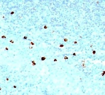 Anti-IgM Antibody