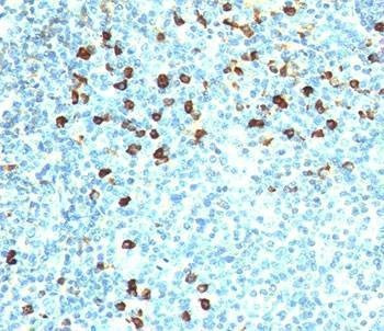 Anti-Kappa Antibody
