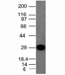 Anti-Kappa Antibody