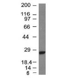 Anti-Kappa Light Chain Antibody