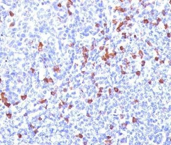 Anti-Kappa Light Chain Antibody