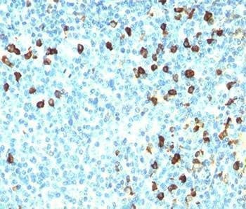 Anti-Lambda Light Chain Antibody