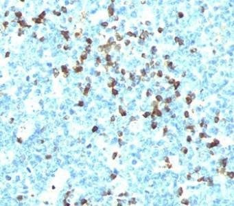 Anti-Lambda Light Chain Antibody
