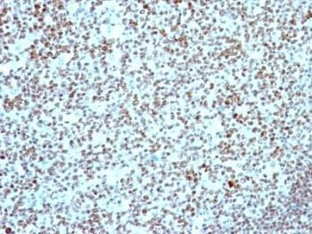 Anti-Nucleolin Antibody