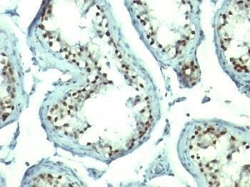 Anti-Nucleolin Antibody