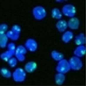Anti-Nucleolin Antibody