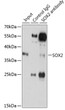 Immunoprecipitation analysis of 200 Mu g extracts of C6 cells using 3 Mu g SOX2 antibody (STJ25661). Western blot was performed from the immunoprecipitate using SOX2 antibody (STJ25661) at a dilution of 1:500.