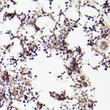 Immunohistochemistry analysis of paraffin-embedded rat bone marrow using TET2 antibody (STJ25816) at dilution of 1:100 (40x lens). Perform high pressure antigen retrieval with 10 mM citrate buffer pH 6. 0 before commencing with immunohistochemistry staining protocol.
