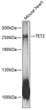Western blot analysis of lysates from mouse heart, using TET2 Rabbit pAb (STJ27649) at 1:1000 dilution. <br/>Secondary antibody: HRP-conjugated Goat anti-Rabbit IgG (H+L) (STJS000856) at 1:10000 dilution. <br/>Lysates/proteins: 25 Mu g per lane. <br/>Blocking buffer: 3% nonfat dry milk in TBST. <br/>Detection: ECL Basic Kit <br/>Exposure time: 10s.