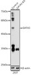 Western blot analysis of extracts from normal (control) and GATA3 knockout (KO) 293T cells, using GATA3 antibody (STJ28052) at 1:1000 dilution. Secondary antibody: HRP Goat Anti-Rabbit IgG (H+L) (STJS000856) at 1:10000 dilution. Lysates/proteins: 25 Mu g per lane. Blocking buffer: 3% nonfat dry milk in TBST. Detection: ECL Enhanced Kit. Exposure time: 180s.