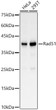 Western blot analysis of various lysates, using Rad51 antibody (STJ28190) at 1:400 dilution. Secondary antibody: HRP Goat Anti-rabbit IgG (H+L) (STJS000856) at 1:10000 dilution. Lysates/proteins: 25 Mu g per lane. Blocking buffer: 3% non-fat dry milk in TBST. Detection: ECL Basic Kit. Exposure time: 10s.
