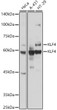 Western blot analysis of various lysates, using KLF4 antibody (STJ28723) at 1:1000 dilution. Secondary antibody: HRP Goat Anti-rabbit IgG (H+L) (STJS000856) at 1:10000 dilution. Lysates/proteins: 25 Mu g per lane. Blocking buffer: 3% non-fat dry milk in TBST. Detection: ECL Basic Kit. Exposure time: 30s.