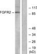 Western blot analysis of lysates from A549 cells, using FGFR2 Antibody. The lane on the right is blocked with the synthesized peptide.