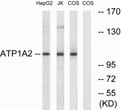 Western blot analysis of lysates from COS7 cells, HepG2 cells, and Jurkat cells, using ATP1A2 Antibody. The lane on the STJ94339