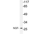 Western blot analysis of lysate from Jurkat cells, using NGF antibody.