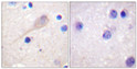 Immunohistochemistry analysis of paraffin-embedded human brain tissue, using Parkin Antibody. The picture on the right is blocked with the synthesized peptide.