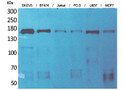 Western Blot analysis of SKOV3, BT474, Jurkat, PC-3, U937, and MCF7 cells using SCP-2 Polyclonal Antibody. Secondary STJ96481