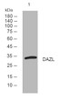 Western blot analysis of lysates from MDA-MB cells, primary antibody was diluted at 1:1000, 4°C over night