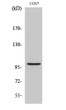 Western Blot analysis of various cells using AAK1 Polyclonal Antibody STJ91403