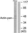 Western blot analysis of lysates from HeLa cells, using Actin-pan Antibody. The lane on the right is blocked with the synthesized peptide.