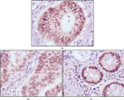 Immunohistochemistry analysis of paraffin-embedded human colon cancer (A) , gastric cancer (B) and rectal cance<style>.product-options .custom-field{display:inline-block;background:#aaa;}</style><style>.label-data{font-weight:bold;min-width:100px;}.label-data,.data{display:inline-block;min-width:100px;}.description table{word-break:break-all;}.description table td{min-width:200px;}</style></div></div></div>
				      </div>
                      </div>
  </div>

    </div>




<div class=