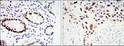 Immunohistochemistry analysis of paraffin-embedded colon cancer t<style>.product-options .custom-field{display:inline-block;background:#aaa;}</style><style>.label-data{font-weight:bold;min-width:100px;}.label-data,.data{display:inline-block;min-width:100px;}.description table{word-break:break-all;}.description table td{min-width:200px;}</style></div></div></div>
				      </div>
                      </div>
  </div>

    </div>




<div class=