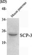 Western blot analysis using SCP-3 monoclonal antibody against mouse pancreas lysate.