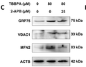 Polysaccharides from Tetrastigma Hemsleyanum Diels et Gilg ameliorated inflammatory bowel disease by rebuilding the intestinal mucosal barrier and inh<style>.product-options .custom-field{display:inline-block;background:#aaa;}</style><style>.label-data{font-weight:bold;min-width:100px;}.label-data,.data{display:inline-block;min-width:100px;}.description table{word-break:break-all;}.description table td{min-width:200px;}</style></div></div></div>
				      </div>
                      </div>
  </div>

    </div>




<div class=