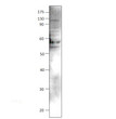 Western blot with Anti-ULK3 Antibody (STJ503467) with ULK3 peptide. Antibody at 1:500 dilution in buffer.