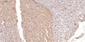 Immunohistochemical analysis of paraffin-embedded human brain tissue. 1, Polyclonal Antibody was diluted at 1:200 (4°C overnight). 2, EDTA pH 9.0 was used for antigen retrieval (>98°C, 20min). 3, Secondary antibody was diluted at 1:200 (room temperature, 30min) Negtive control was used by secondary antibody only.)