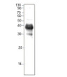 Western blot with Anti-CAB13 Antibody (STJ500333) on tomato plant extract at 1:500 dilution in buffer.