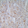 Anti-FSH antibody (STJ16101325)