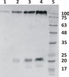 Anti-Zaire Ebolavirus GP protein antibody (STJA0002915)