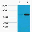 Western blot analysis of Maize 1) Dark, 2) Light, dilu<style>.product-options .custom-field{display:inline-block;background:#aaa;}</style><style>.label-data{font-weight:bold;min-width:100px;}.label-data,.data{display:inline-block;min-width:100px;}.description table{word-break:break-all;}.description table td{min-width:200px;}</style></div></div></div>
				      </div>
                      </div>
  </div>

    </div>




<div class=