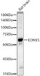 Western blot analysis of Rat brain, using EOMES antibody (STJ11100179) at 1:700 dilution. Secondary antibody: HRP Goat Anti-rabbit IgG (H+L) (STJS000856) at 1:10000 dilution. Lysates/proteins: 25 Mu g per lane. Blocking buffer: 3% non-fat dry milk in TBST. Detection: ECL Basic Kit. Exposure time: 30s.