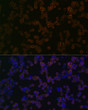 Immunofluorescence analysis of THP-1 cells using T<style>.product-options .custom-field{display:inline-block;background:#aaa;}</style><style>.label-data{font-weight:bold;min-width:100px;}.label-data,.data{display:inline-block;min-width:100px;}.description table{word-break:break-all;}.description table td{min-width:200px;}</style></div></div></div>
				      </div>
                      </div>
  </div>

    </div>




<div class=