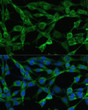 Immunofluorescence analysis of NIH/3T3 cells using Smad3 Rabbit polyclonal antibody (STJ11101192) at dilution of 1:100. Blue: DAPI for nuclear staining.